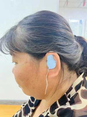 双耳听力95助听器有用吗（双耳听力95助听器有用吗知乎）