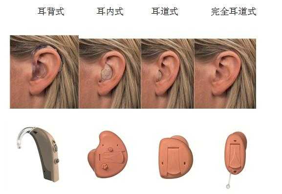 耳膜穿孔带助听器有用吗（耳膜穿孔戴助听器有效果吗）